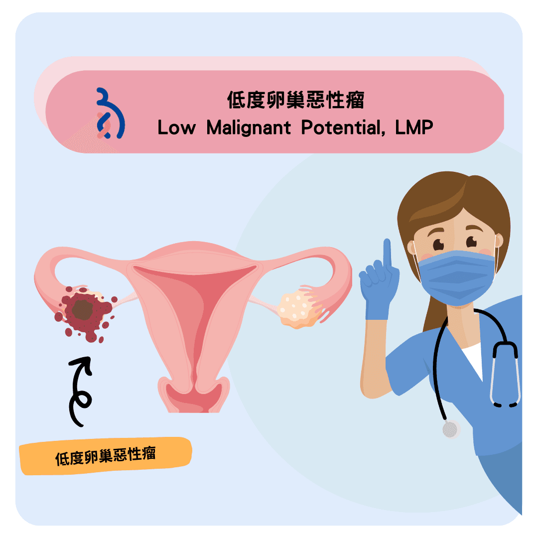 何謂低度卵巢惡性瘤(Low Malignant Potential, LMP).png