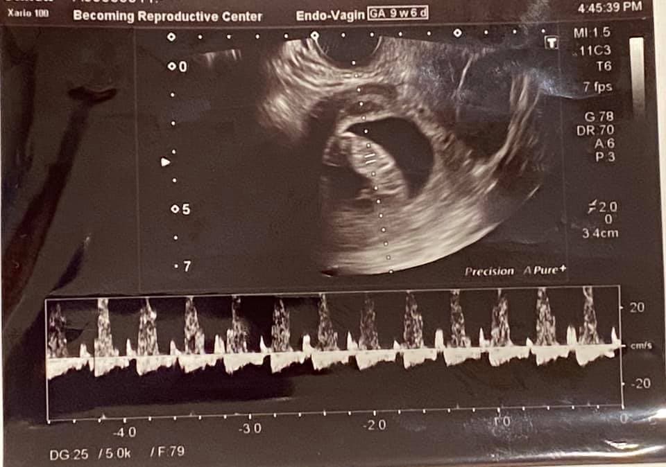 🤰懷孕了!還要擔心什麼🤔?.jpg