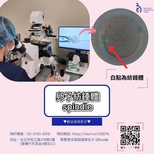 紡錘體觀測儀-卵子大解析.jpg